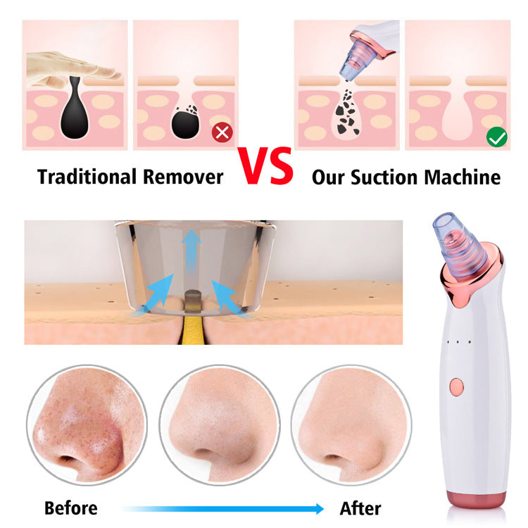 Multi-Functional Blackhead Remover Vacuum Tool For Pore Cleansing And Acne Treatment