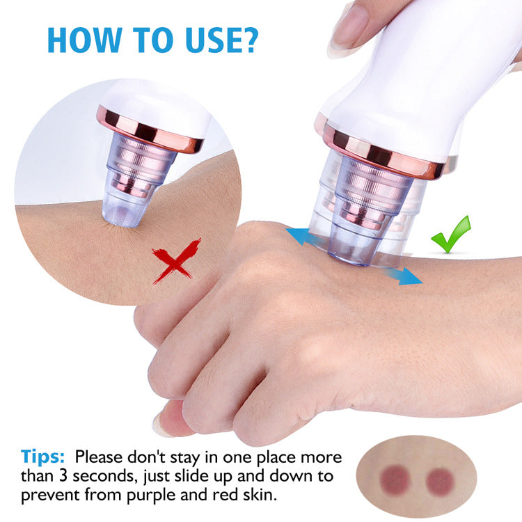 Multi-Functional Blackhead Remover Vacuum Tool For Pore Cleansing And Acne Treatment