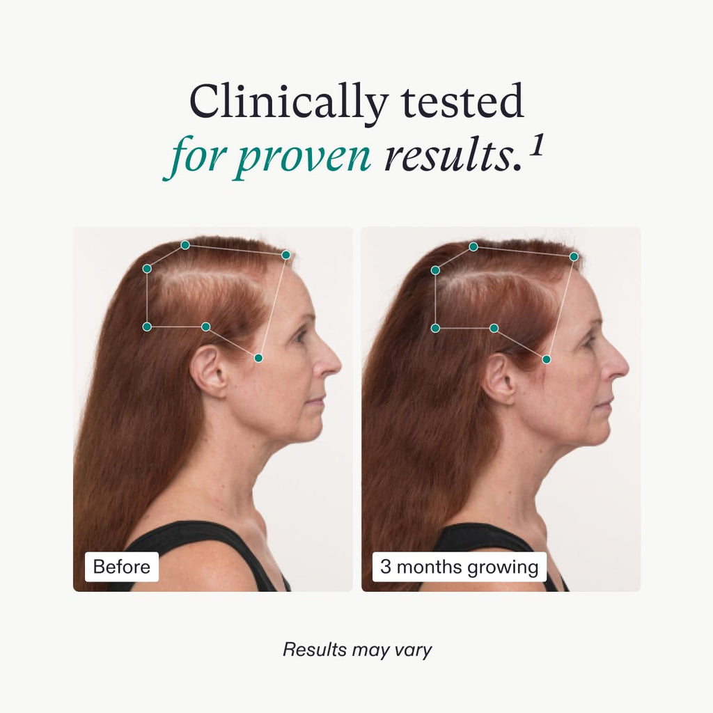 Nutrafol Women's Balance Hair Growth Supplements, Ages 45 and Up, Clinically Proven Hair Supplement for Visibly Thicker Hair and Scalp Coverage, Dermatologist Recommended - 1 Month Supply