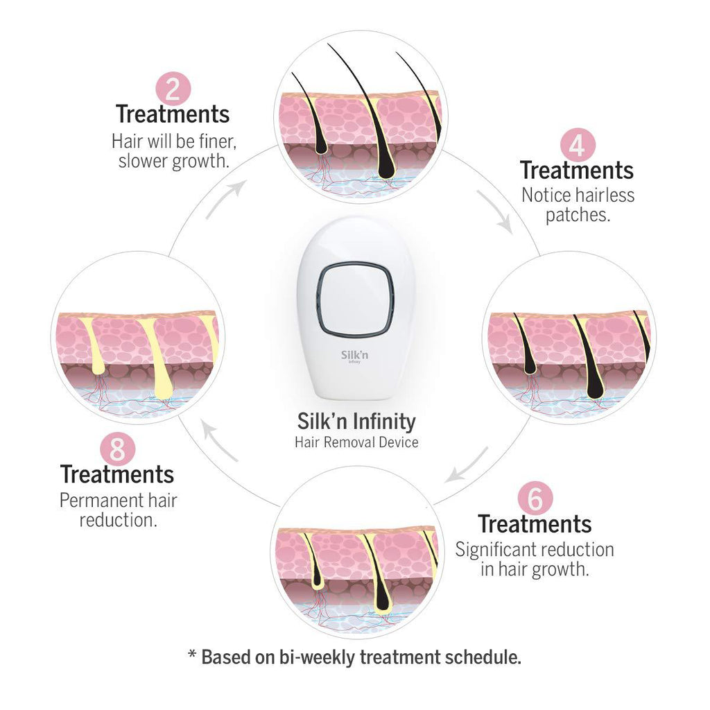 Silk’n Infinity - At Home Permanent Hair Removal for Women and Men, Lifetime of Pulses, No Refill CartridNeeded, Unlimited Flashes - IPL Laser Hair Removal System