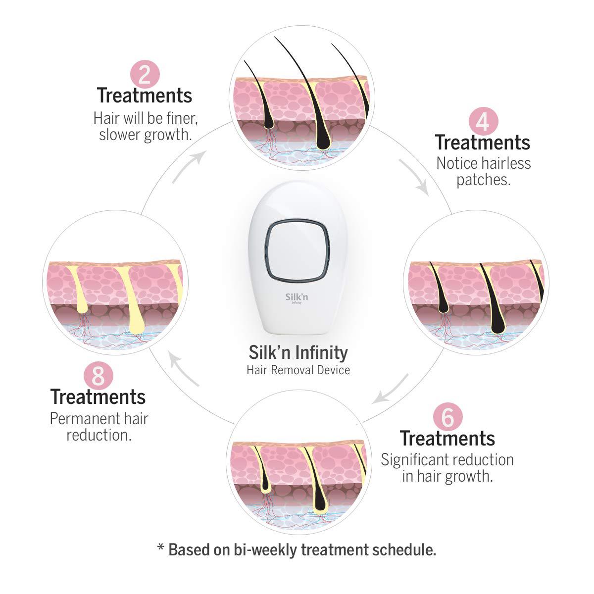 Silk’n Infinity - At Home Permanent Hair Removal for Women and Men, Lifetime of Pulses, No Refill CartridNeeded, Unlimited Flashes - IPL Laser Hair Removal System